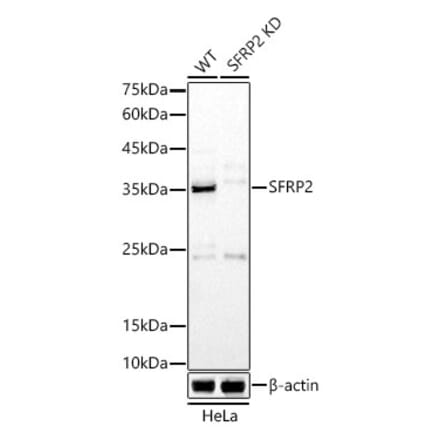 Western Blot - Anti-SFRP2 Antibody (A307514) - Antibodies.com