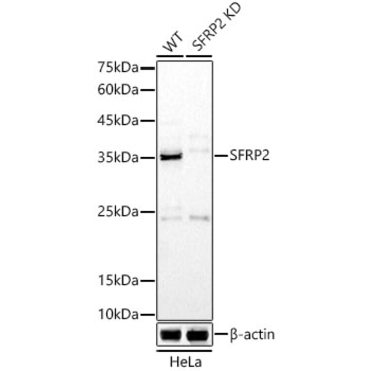 Western Blot - Anti-SFRP2 Antibody (A307514) - Antibodies.com