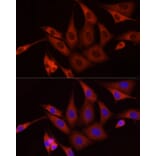 Immunofluorescence - Anti-SFRP2 Antibody (A307514) - Antibodies.com