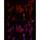 Immunofluorescence - Anti-SFRP2 Antibody (A307514) - Antibodies.com