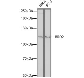 Western Blot - Anti-BRD2 Antibody (A307515) - Antibodies.com