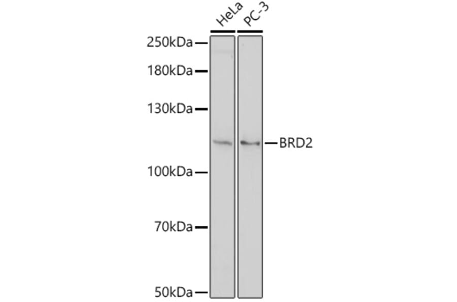 Western Blot - Anti-BRD2 Antibody (A307515) - Antibodies.com