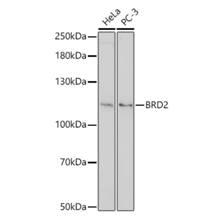 Western Blot - Anti-BRD2 Antibody (A307515) - Antibodies.com