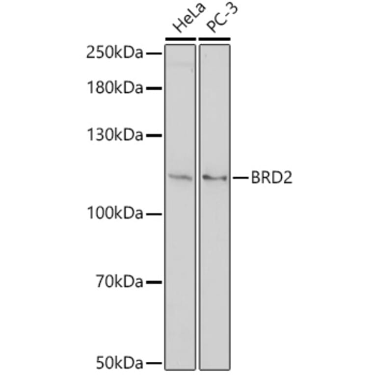Western Blot - Anti-BRD2 Antibody (A307515) - Antibodies.com