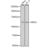 Western Blot - Anti-BRD2 Antibody (A307515) - Antibodies.com