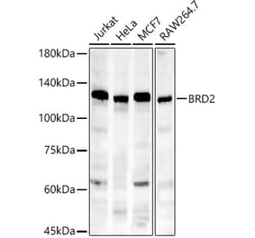 Western Blot - Anti-BRD2 Antibody [ARC56992] (A307516) - Antibodies.com