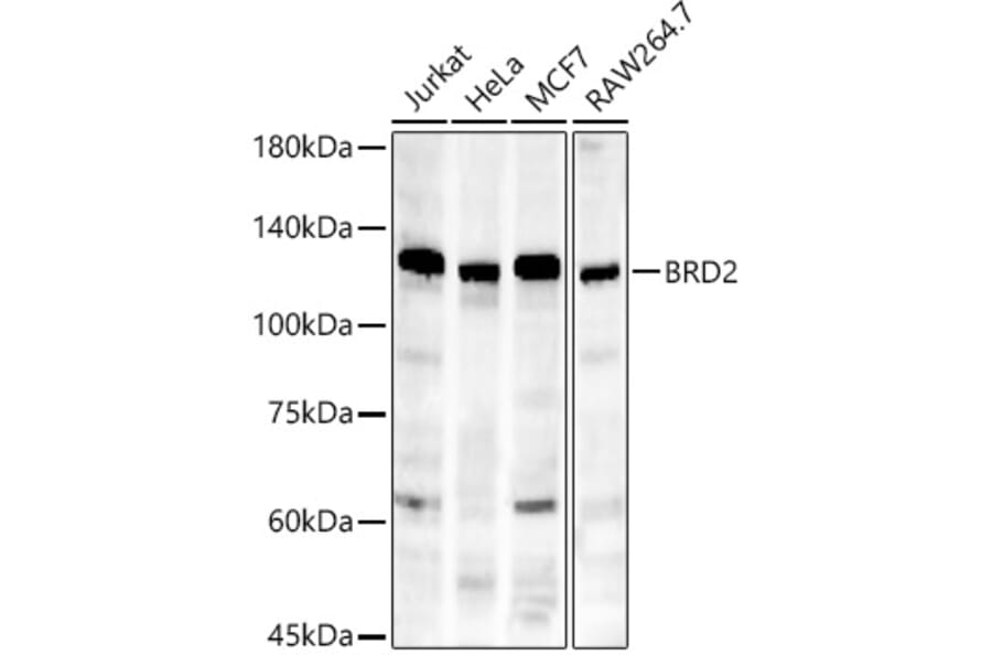 Western Blot - Anti-BRD2 Antibody [ARC56992] (A307516) - Antibodies.com