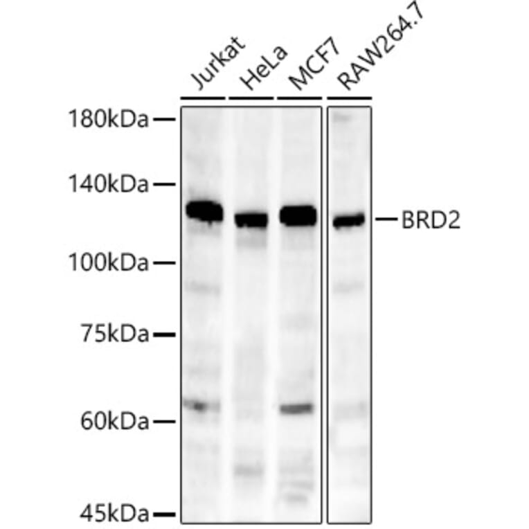 Western Blot - Anti-BRD2 Antibody [ARC56992] (A307516) - Antibodies.com