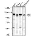 Western Blot - Anti-BRD2 Antibody [ARC56992] (A307516) - Antibodies.com