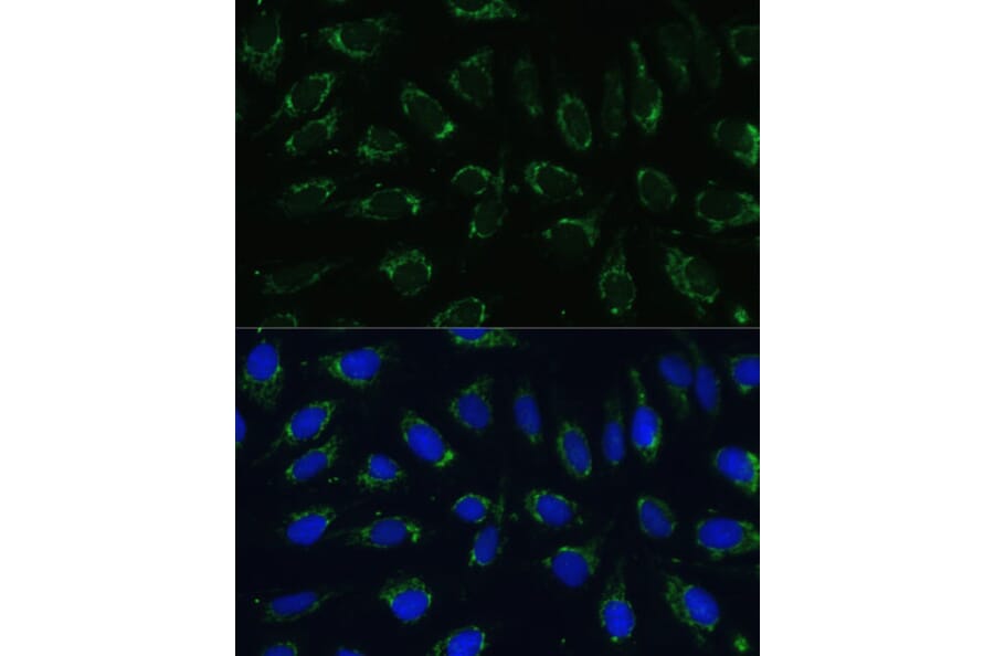 Immunofluorescence - Anti-NDUFA4 Antibody (A307518) - Antibodies.com
