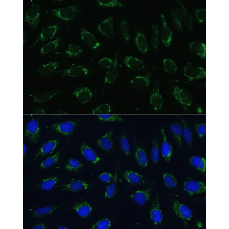 Immunofluorescence - Anti-NDUFA4 Antibody (A307518) - Antibodies.com