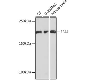 Western Blot - Anti-EEA1 Antibody [ARC1250] (A307520) - Antibodies.com