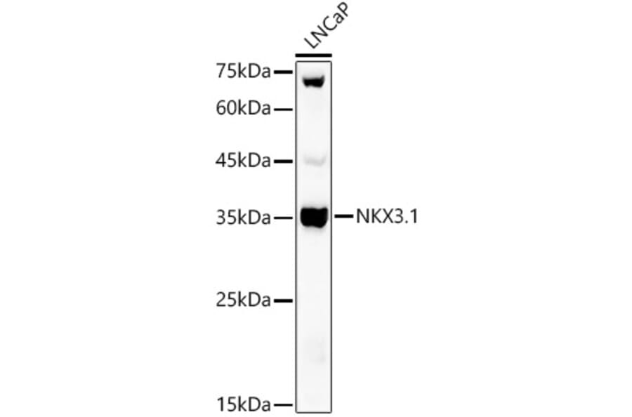 Western Blot - Anti-Nkx3.1 Antibody (A307522) - Antibodies.com