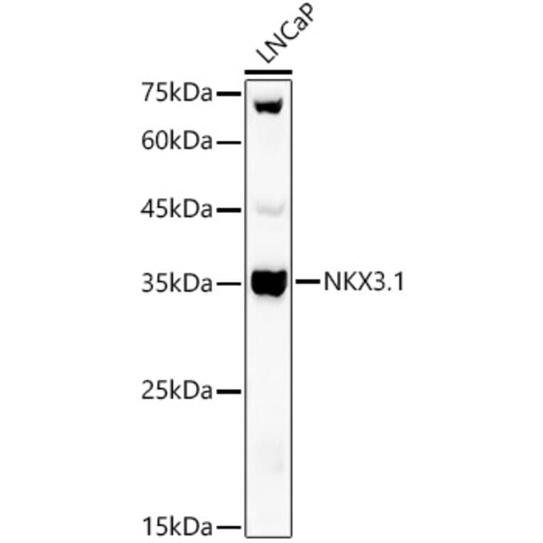 Western Blot - Anti-Nkx3.1 Antibody (A307522) - Antibodies.com