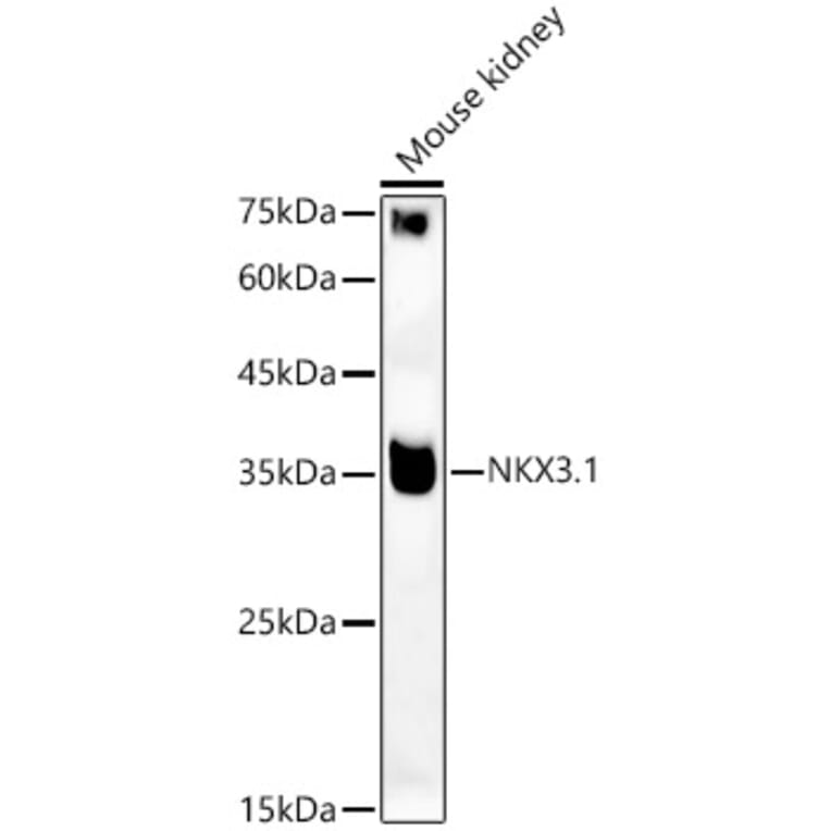 Western Blot - Anti-Nkx3.1 Antibody (A307522) - Antibodies.com