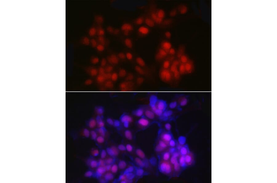 Immunofluorescence - Anti-Nkx3.1 Antibody (A307522) - Antibodies.com