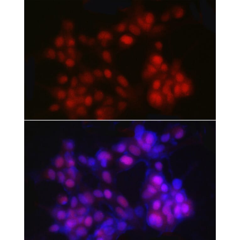 Immunofluorescence - Anti-Nkx3.1 Antibody (A307522) - Antibodies.com