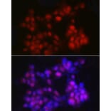 Immunofluorescence - Anti-Nkx3.1 Antibody (A307522) - Antibodies.com