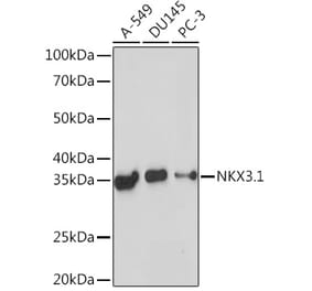 Western Blot - Anti-Nkx3.1 Antibody [ARC2261] (A307523) - Antibodies.com