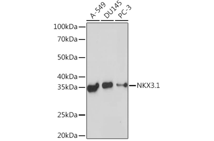 Western Blot - Anti-Nkx3.1 Antibody [ARC2261] (A307523) - Antibodies.com