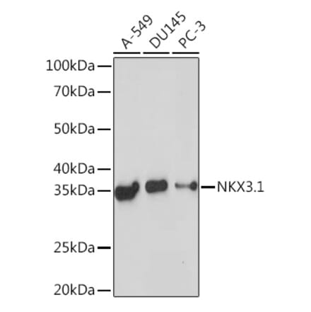 Western Blot - Anti-Nkx3.1 Antibody [ARC2261] (A307523) - Antibodies.com