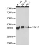 Western Blot - Anti-Nkx3.1 Antibody [ARC2261] (A307523) - Antibodies.com