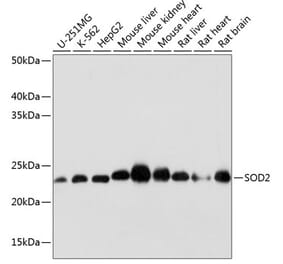 Western Blot - Anti-SOD2/MnSOD Antibody [ARC0055] (A307524) - Antibodies.com