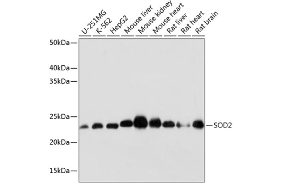 Western Blot - Anti-SOD2/MnSOD Antibody [ARC0055] (A307524) - Antibodies.com