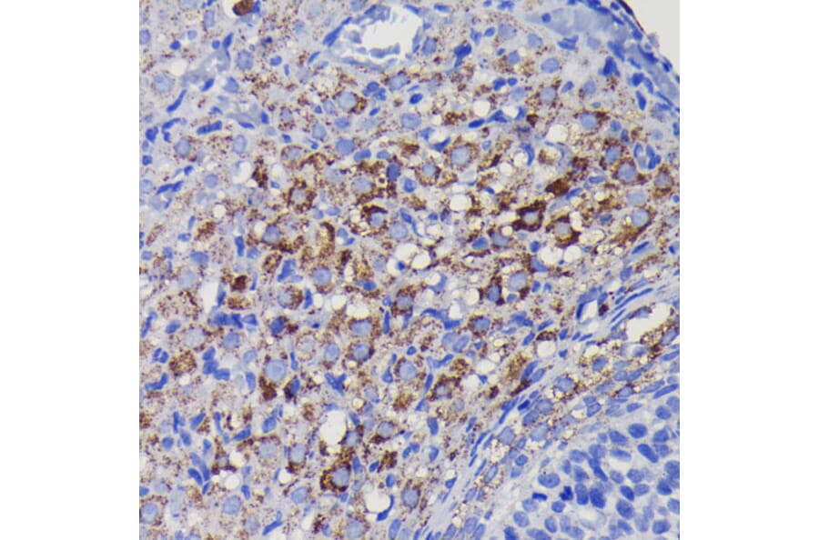 Immunohistochemistry - Anti-SOD2/MnSOD Antibody [ARC0055] (A307524) - Antibodies.com