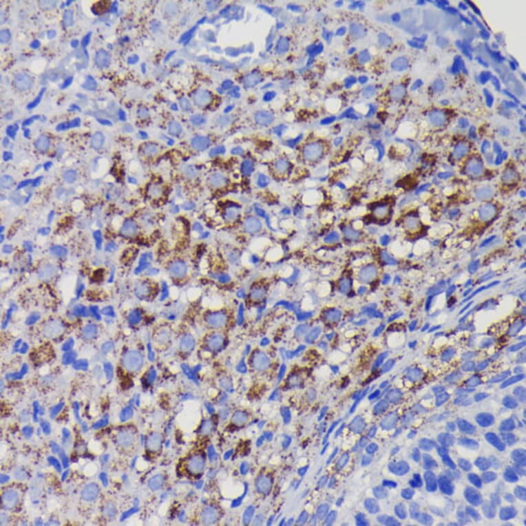 Immunohistochemistry - Anti-SOD2/MnSOD Antibody [ARC0055] (A307524) - Antibodies.com