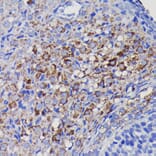 Immunohistochemistry - Anti-SOD2/MnSOD Antibody [ARC0055] (A307524) - Antibodies.com