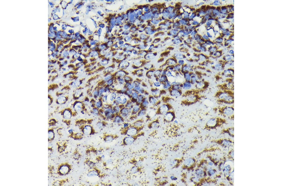 Immunohistochemistry - Anti-SOD2/MnSOD Antibody [ARC0055] (A307524) - Antibodies.com