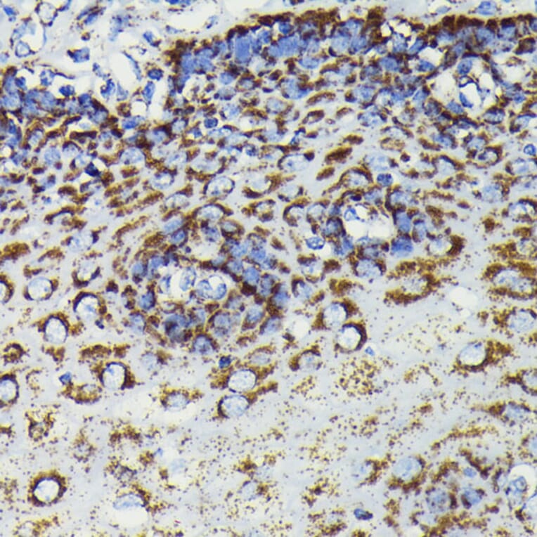 Immunohistochemistry - Anti-SOD2/MnSOD Antibody [ARC0055] (A307524) - Antibodies.com