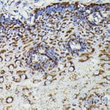 Immunohistochemistry - Anti-SOD2/MnSOD Antibody [ARC0055] (A307524) - Antibodies.com