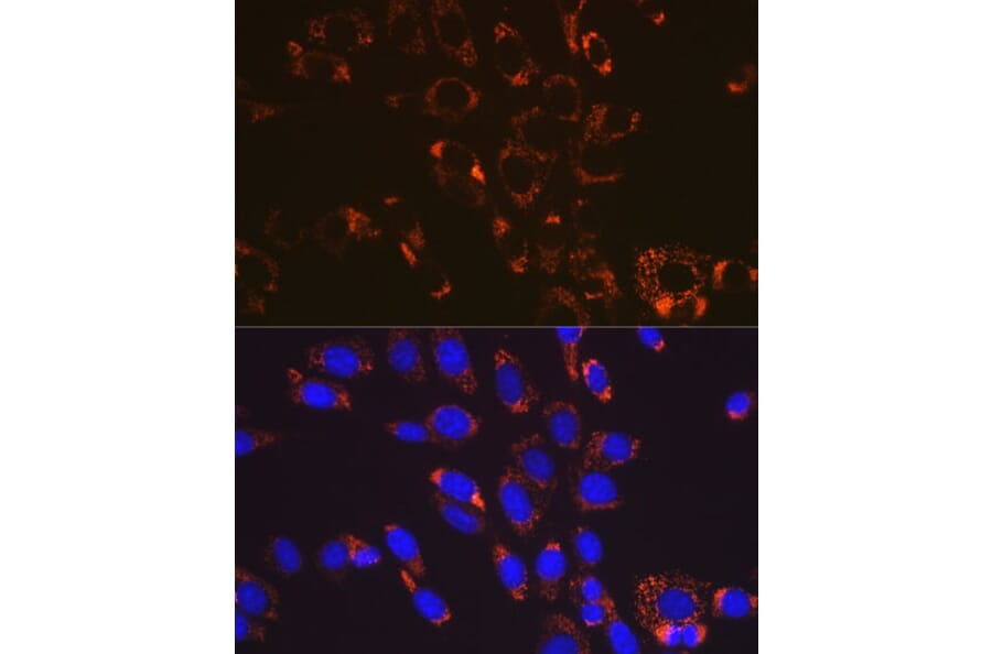 Immunofluorescence - Anti-SOD2/MnSOD Antibody [ARC0055] (A307524) - Antibodies.com