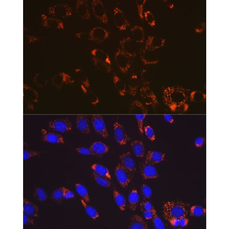 Immunofluorescence - Anti-SOD2/MnSOD Antibody [ARC0055] (A307524) - Antibodies.com