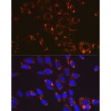 Immunofluorescence - Anti-SOD2/MnSOD Antibody [ARC0055] (A307524) - Antibodies.com