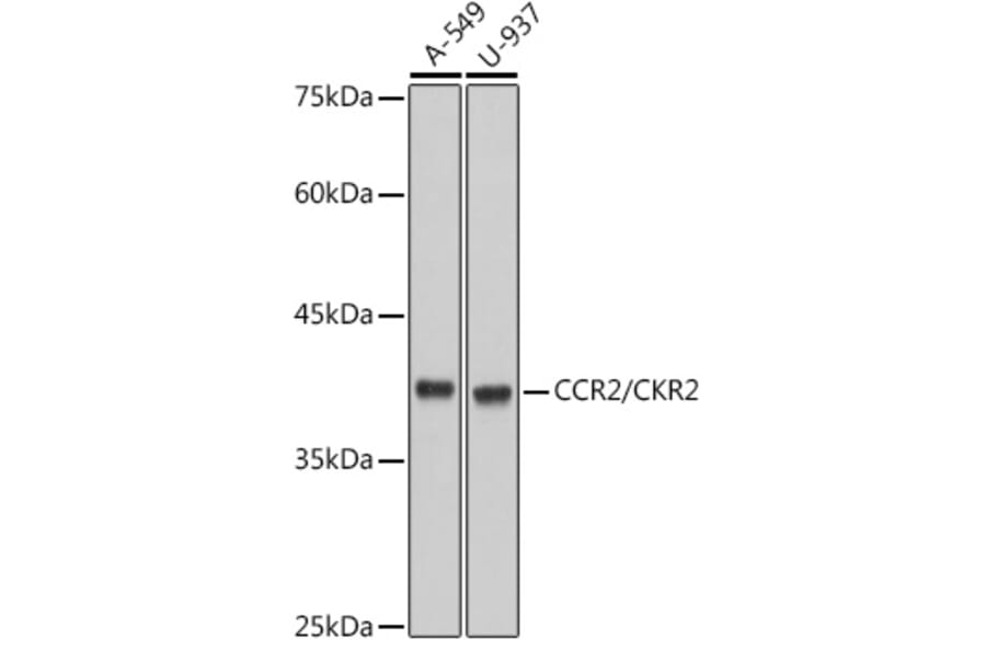 Western Blot - Anti-CCR2 Antibody [ARC2585] (A307525) - Antibodies.com
