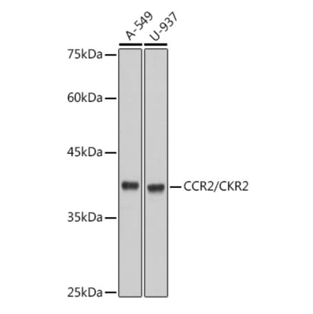 Western Blot - Anti-CCR2 Antibody [ARC2585] (A307525) - Antibodies.com