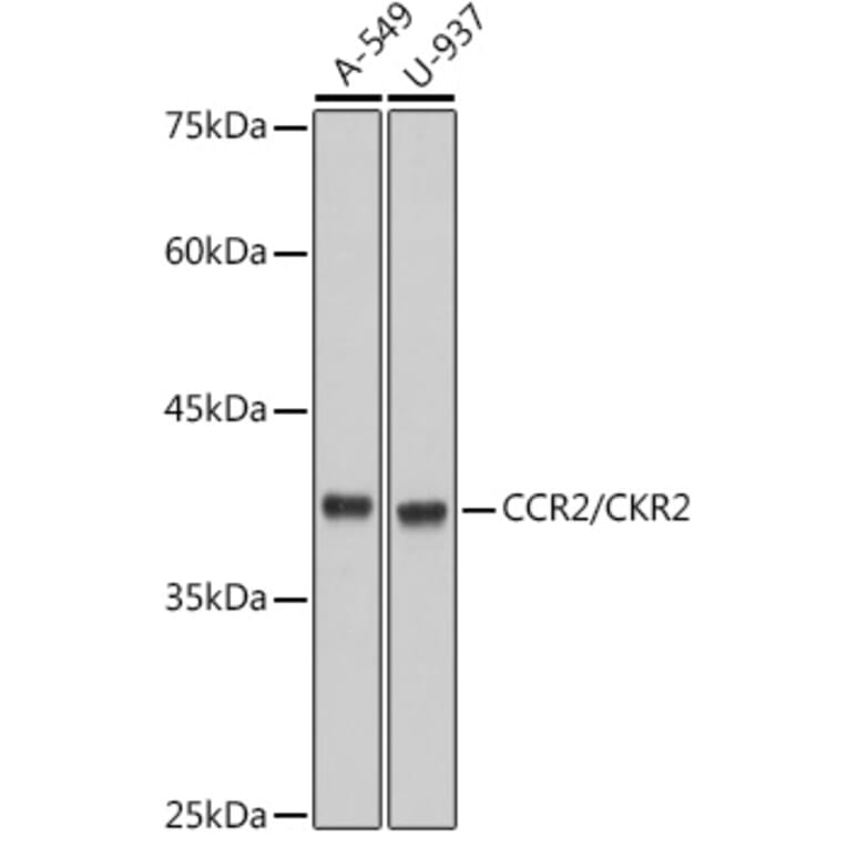 Western Blot - Anti-CCR2 Antibody [ARC2585] (A307525) - Antibodies.com