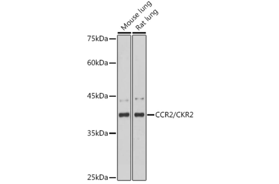 Western Blot - Anti-CCR2 Antibody [ARC2585] (A307525) - Antibodies.com