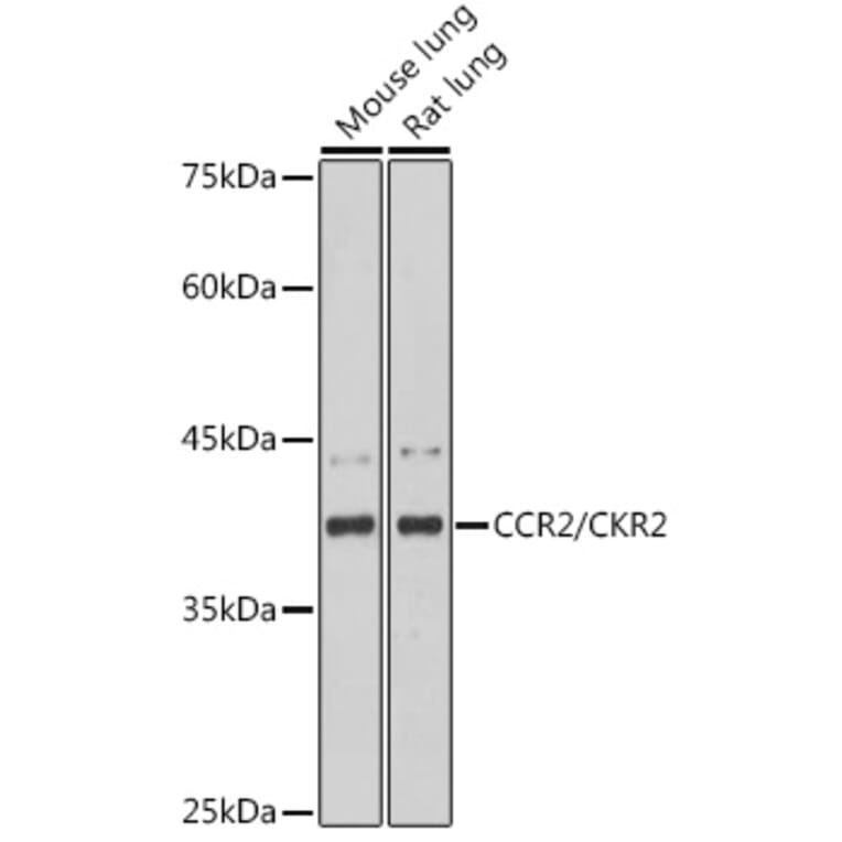 Western Blot - Anti-CCR2 Antibody [ARC2585] (A307525) - Antibodies.com