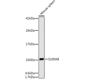 Western Blot - Anti-MRP8 Antibody [ARC0478] (A307526) - Antibodies.com