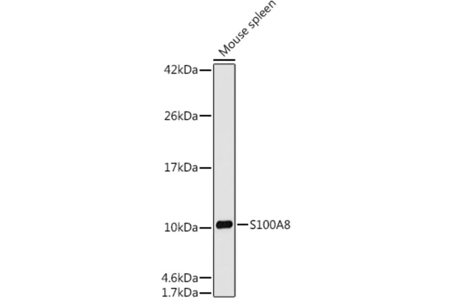 Western Blot - Anti-MRP8 Antibody [ARC0478] (A307526) - Antibodies.com
