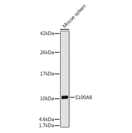 Western Blot - Anti-MRP8 Antibody [ARC0478] (A307526) - Antibodies.com