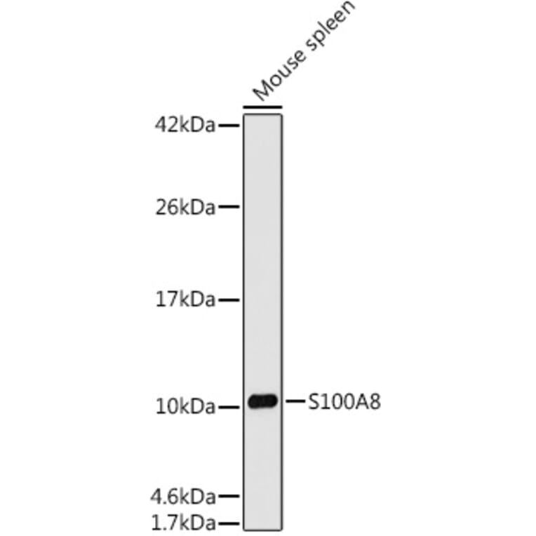 Western Blot - Anti-MRP8 Antibody [ARC0478] (A307526) - Antibodies.com