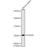 Western Blot - Anti-MRP8 Antibody [ARC0478] (A307526) - Antibodies.com