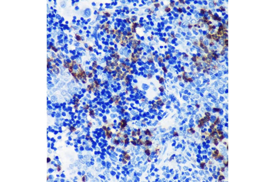 Immunohistochemistry - Anti-MRP8 Antibody [ARC0478] (A307526) - Antibodies.com