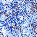 Immunohistochemistry - Anti-MRP8 Antibody [ARC0478] (A307526) - Antibodies.com