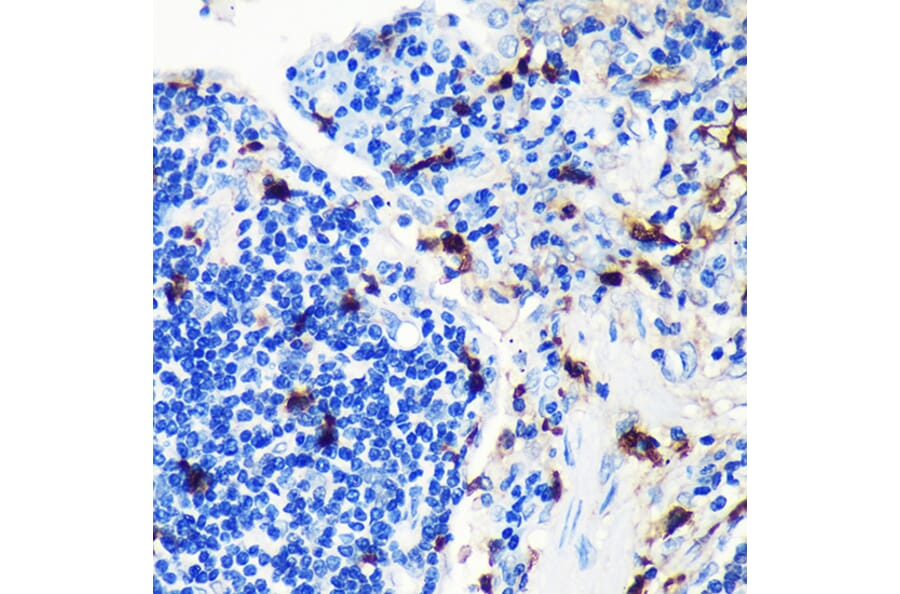 Immunohistochemistry - Anti-MRP8 Antibody [ARC0478] (A307526) - Antibodies.com
